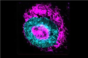 امید به درمان سرطان با کشف ابرقدرت سلول‌های سرطانی
